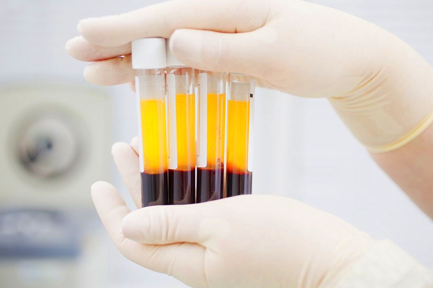 REGENERACIÓN ÓSEA CON APORTE DE PLASMA: Servicios de Bukalix REGENERACIÓN ÓSEA CON APORTE DE PLASMA: Servicios de Bukalix
