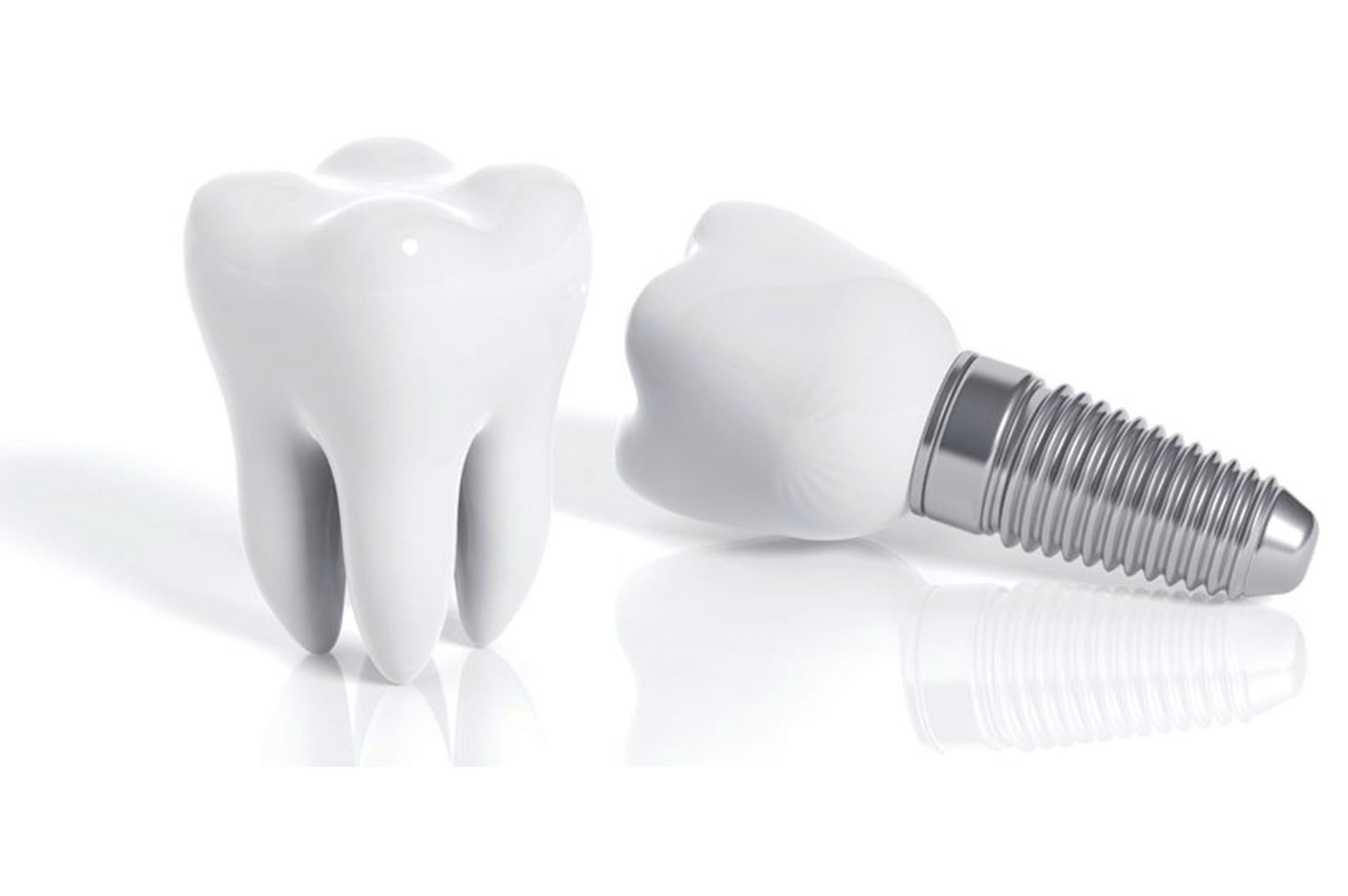 Implants dentals: Catàleg de Bukalix Implants dentals: Catàleg de Bukalix