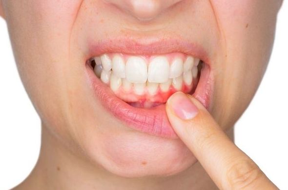 PERIODONCIA: Servicios de Bukalix PERIODONCIA: Servicios de Bukalix