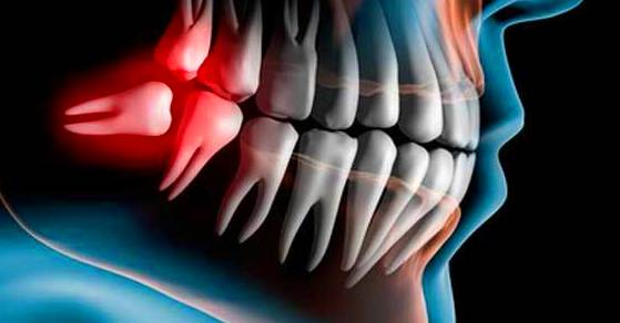 Cirurgia: Catàleg de Bukalix Cirurgia: Catàleg de Bukalix