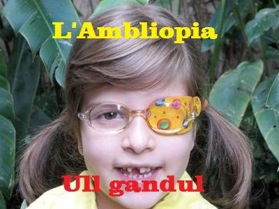 ambliopia ambliopia