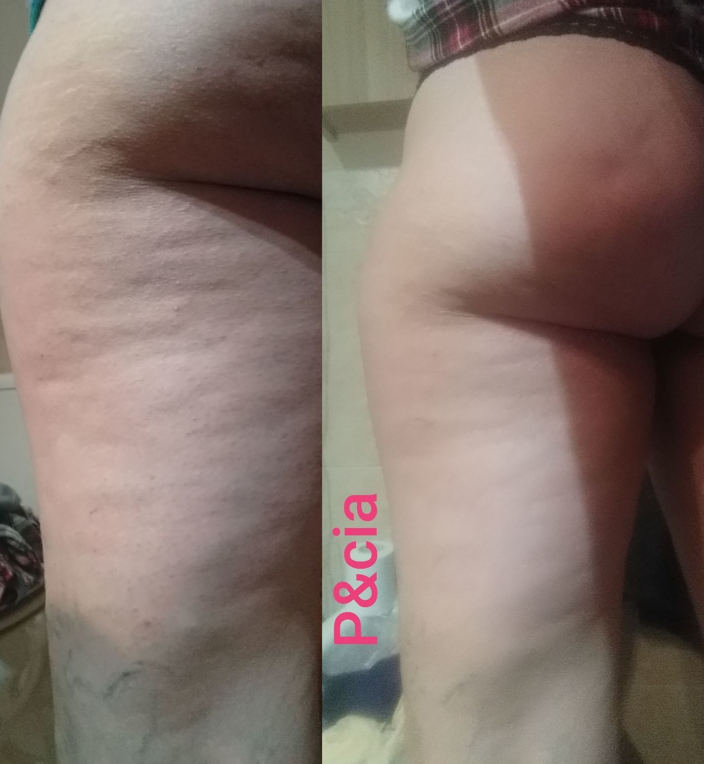 Detox: Nuestros servicios de Patri&cia, Belleza y uñas Detox: Nuestros servicios de Patri&cia, Belleza y uñas