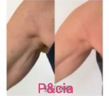 Detox: Nuestros servicios de Patri&cia, Belleza y uñas Detox: Nuestros servicios de Patri&cia, Belleza y uñas