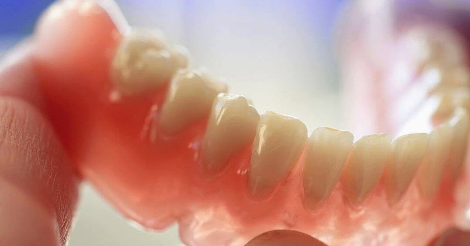 Implantes dentales Granada
