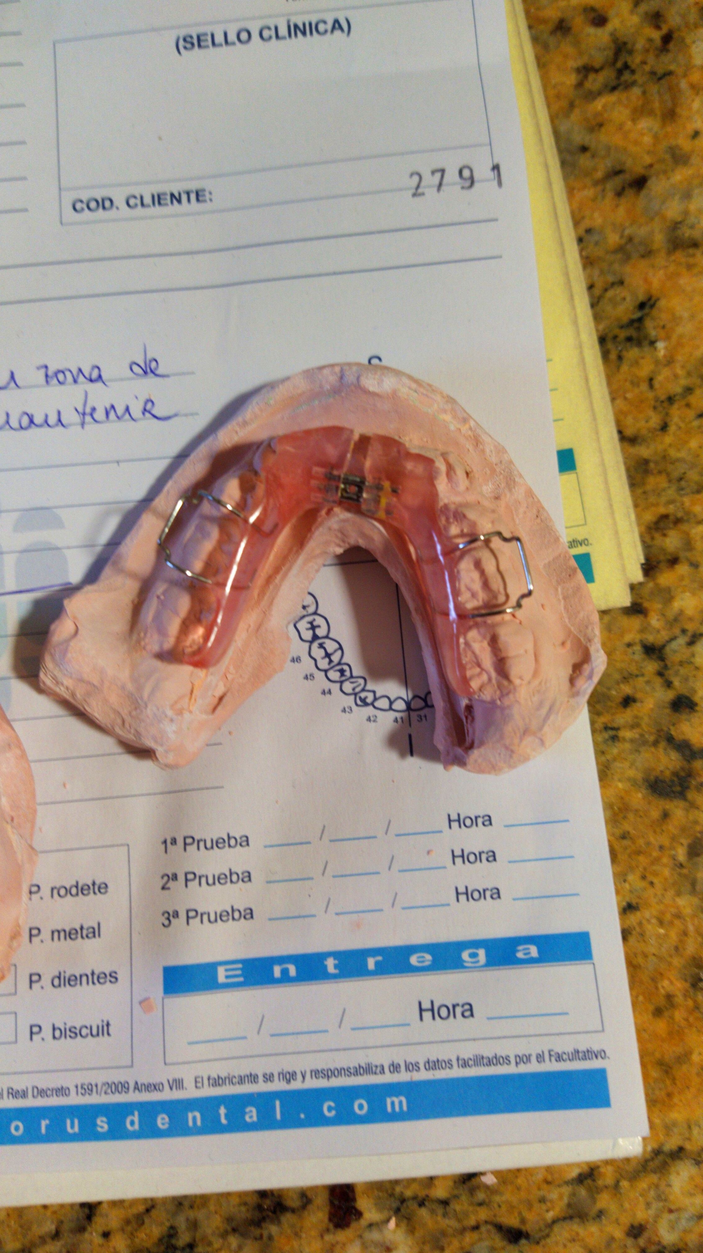 Ortodoncia Removible