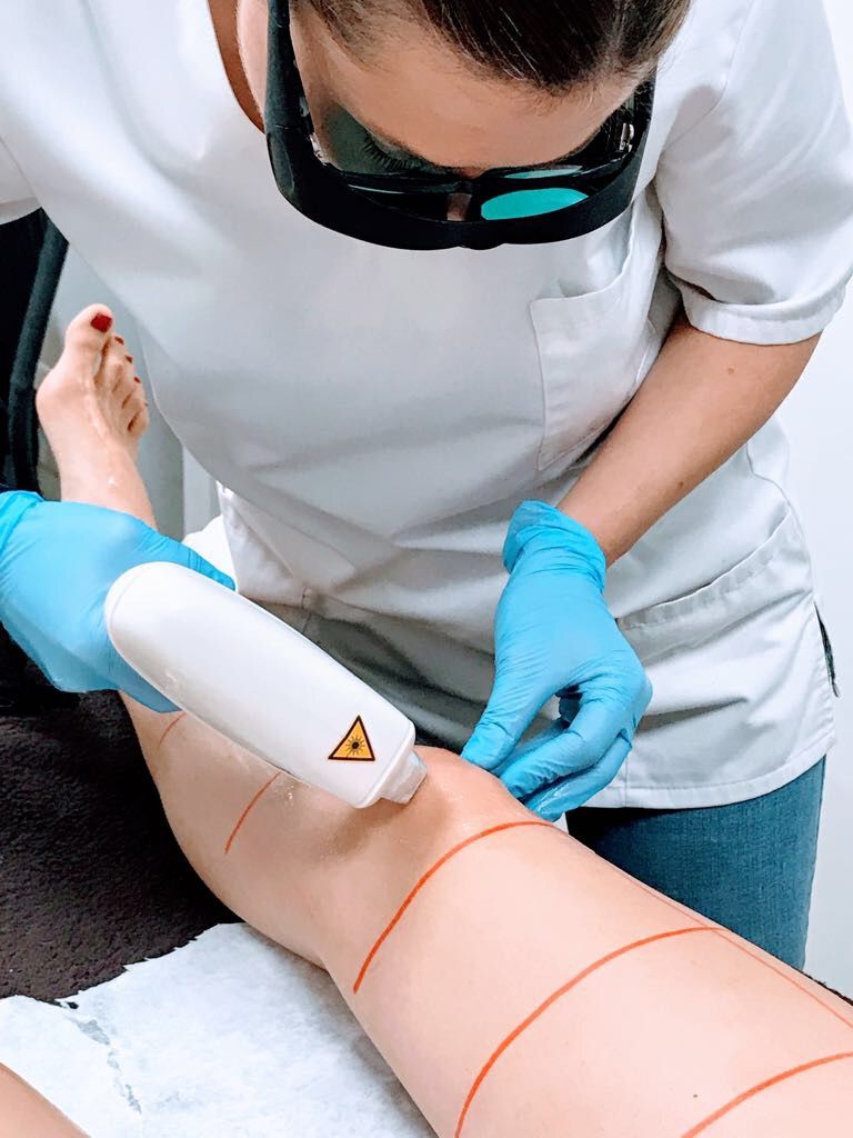 Depilación Láser Diodo: Tratamientos de Montserrat Travé, Clínica Anti-aging y Estética Avanzada Depilación Láser Diodo: Tratamientos de Montserrat Travé, Clínica Anti-aging y Estética Avanzada