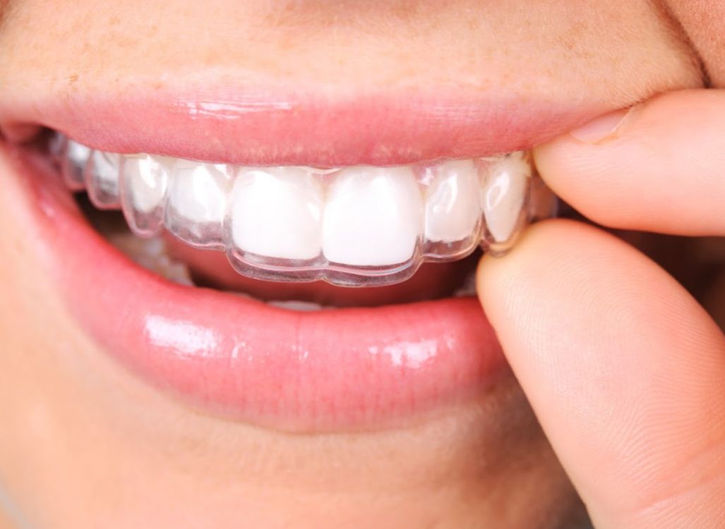 Ortodoncia: Tratamientos de Clínica Dental Dentimar Ortodoncia: Tratamientos de Clínica Dental Dentimar