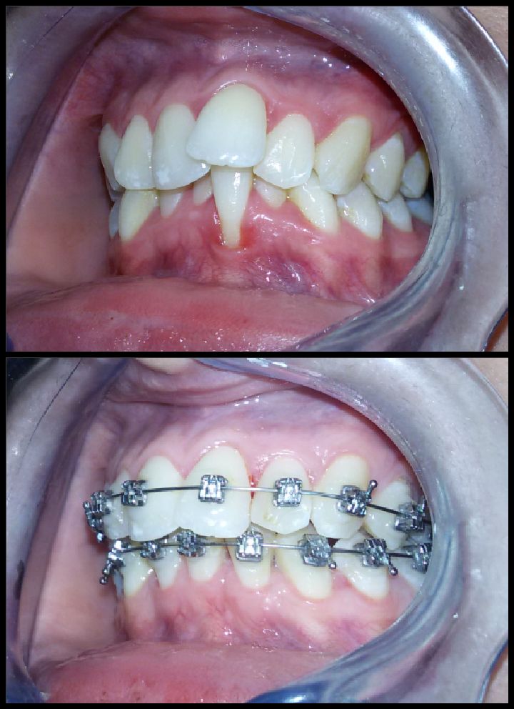Ortodoncia: Tratamientos de Moncloa Clínica Dental Ortodoncia: Tratamientos de Moncloa Clínica Dental