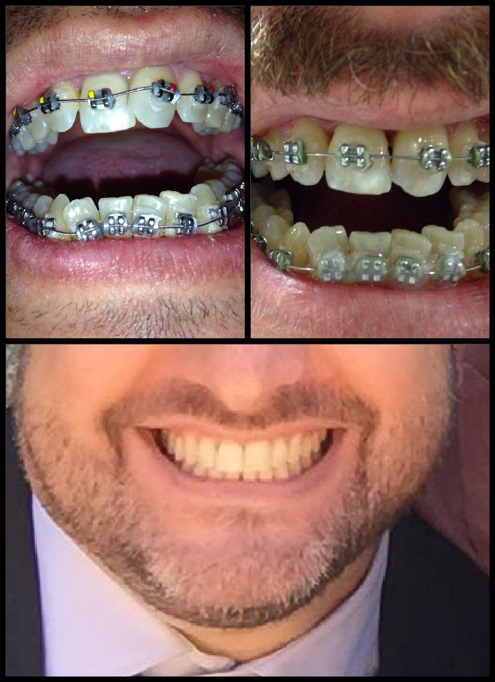 Ortodoncia: Tratamientos de Moncloa Clínica Dental Ortodoncia: Tratamientos de Moncloa Clínica Dental