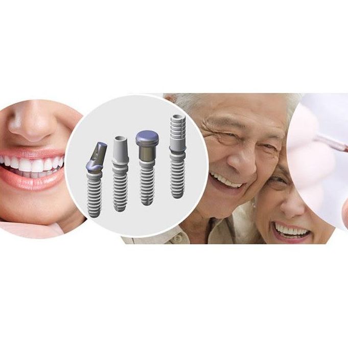 Láser para implantes: Tratamientos de Dental Park Láser para implantes: Tratamientos de Dental Park