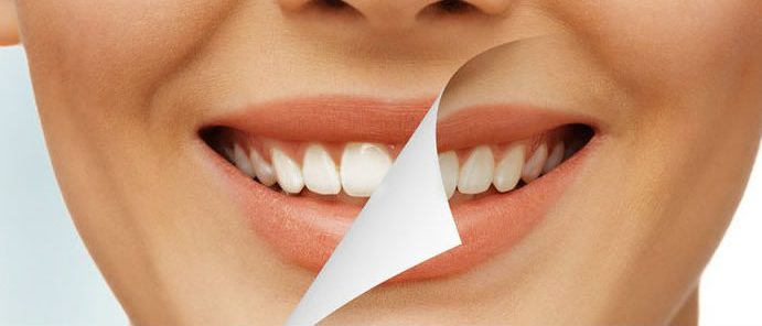 Estética Dental: Tratamientos de Dental Park Estética Dental: Tratamientos de Dental Park
