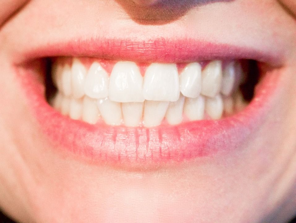 Brackets Estéticos. De zafiro o porcelana: Tratamientos de Moncloa Clínica Dental Brackets Estéticos. De zafiro o porcelana: Tratamientos de Moncloa Clínica Dental
