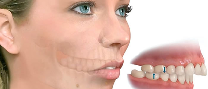 Cirugía Maxilofacial: Tratamientos of Dental Park Cirugía Maxilofacial: Tratamientos of Dental Park