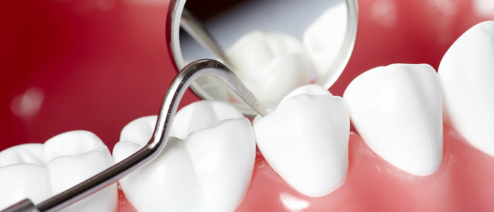 Periodoncia: Tratamientos de Dental Park Periodoncia: Tratamientos de Dental Park