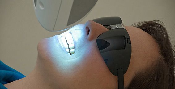 Blanqueamientos dentales: Servicios de Clínica Dental Global Dental Blanqueamientos dentales: Servicios de Clínica Dental Global Dental