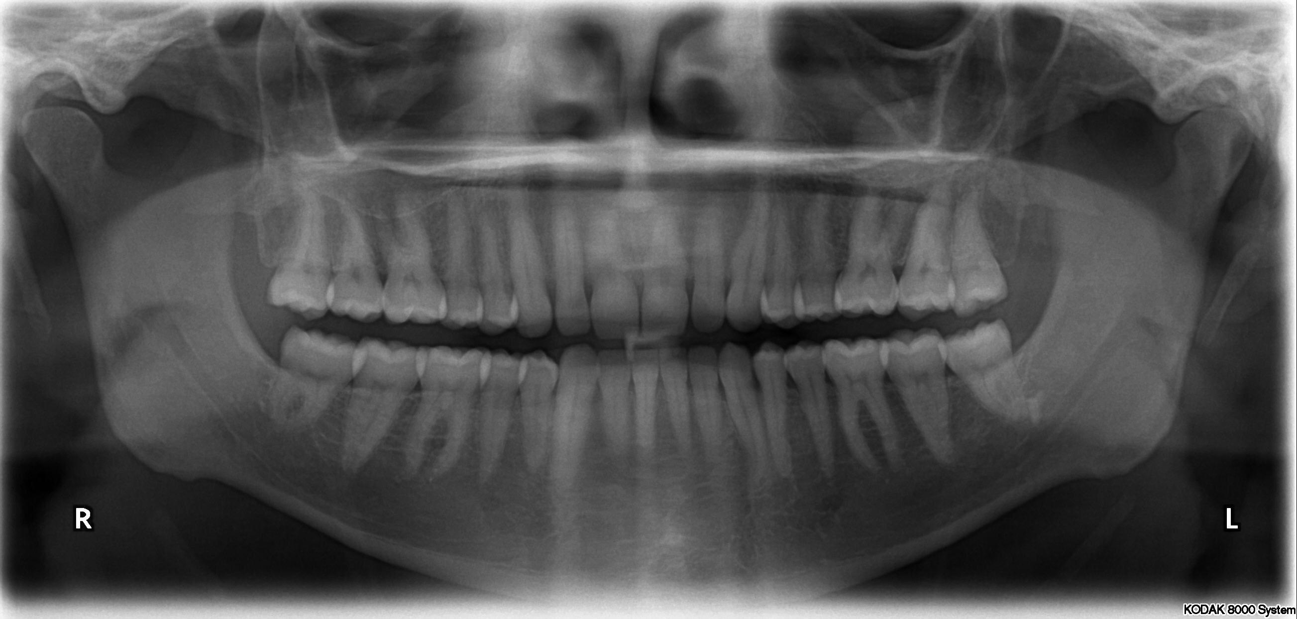 Ortopantomografía: Servicios de Clínica Dental Global Dental Ortopantomografía: Servicios de Clínica Dental Global Dental