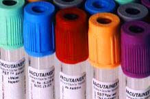 Tubos para extracción de sangre : Productos de PLUS CLINIC Tubos para extracción de sangre : Productos de PLUS CLINIC