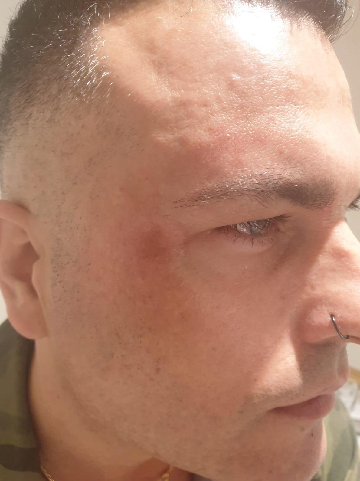 Tratamientos faciales: Servicios de Zafire Estética Tratamientos faciales: Servicios de Zafire Estética