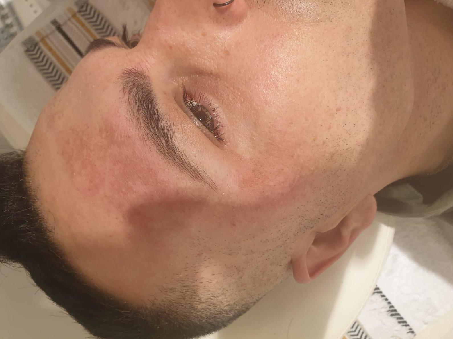Tratamientos faciales: Servicios de Zafire Estética Tratamientos faciales: Servicios de Zafire Estética