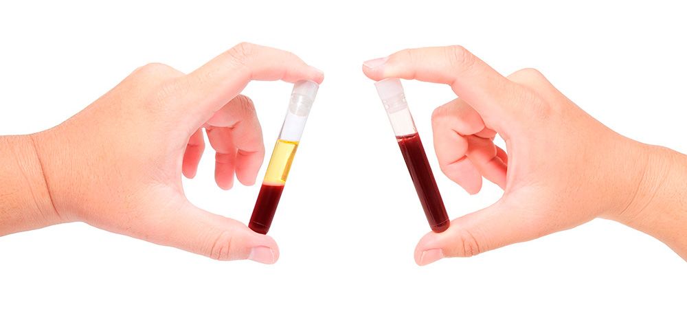 Medicina regenerativa: Tratamientos de Sonría Odontólogos Medicina regenerativa: Tratamientos de Sonría Odontólogos