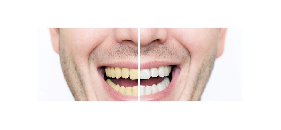 Estética dental: Tratamientos de Sonría Odontólogos Estética dental: Tratamientos de Sonría Odontólogos