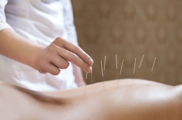 Acupuntura: Terapias de Saüc Salut Acupuntura: Terapias de Saüc Salut