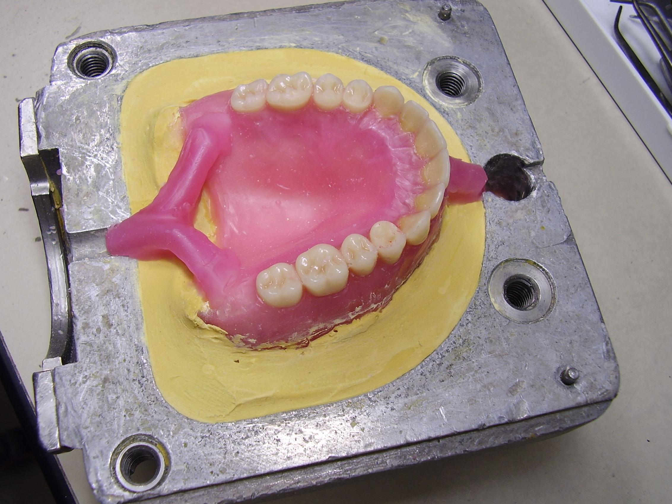 Prótesis: Tratamientos de Clínica Dental Doctor Cortés FC Prótesis: Tratamientos de Clínica Dental Doctor Cortés FC