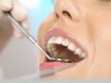 Odontología general: Tratamientos de Clínica Dental Doctor Cortés FC Odontología general: Tratamientos de Clínica Dental Doctor Cortés FC