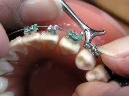 Ortodoncia: Tratamientos de Clínica Dental Doctor Cortés FC Ortodoncia: Tratamientos de Clínica Dental Doctor Cortés FC