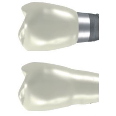 Implantología: Tratamientos de Clínica Dental Doctor Cortés FC Implantología: Tratamientos de Clínica Dental Doctor Cortés FC