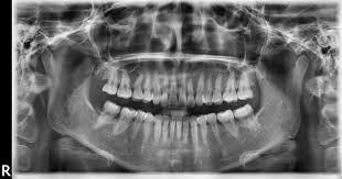 Ortopantomografía: Tratamientos de Clínica Dental Doctor Cortés FC Ortopantomografía: Tratamientos de Clínica Dental Doctor Cortés FC
