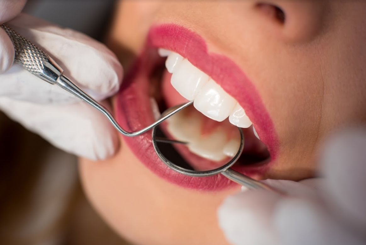 Clínicas dentales Mollet del Vallès