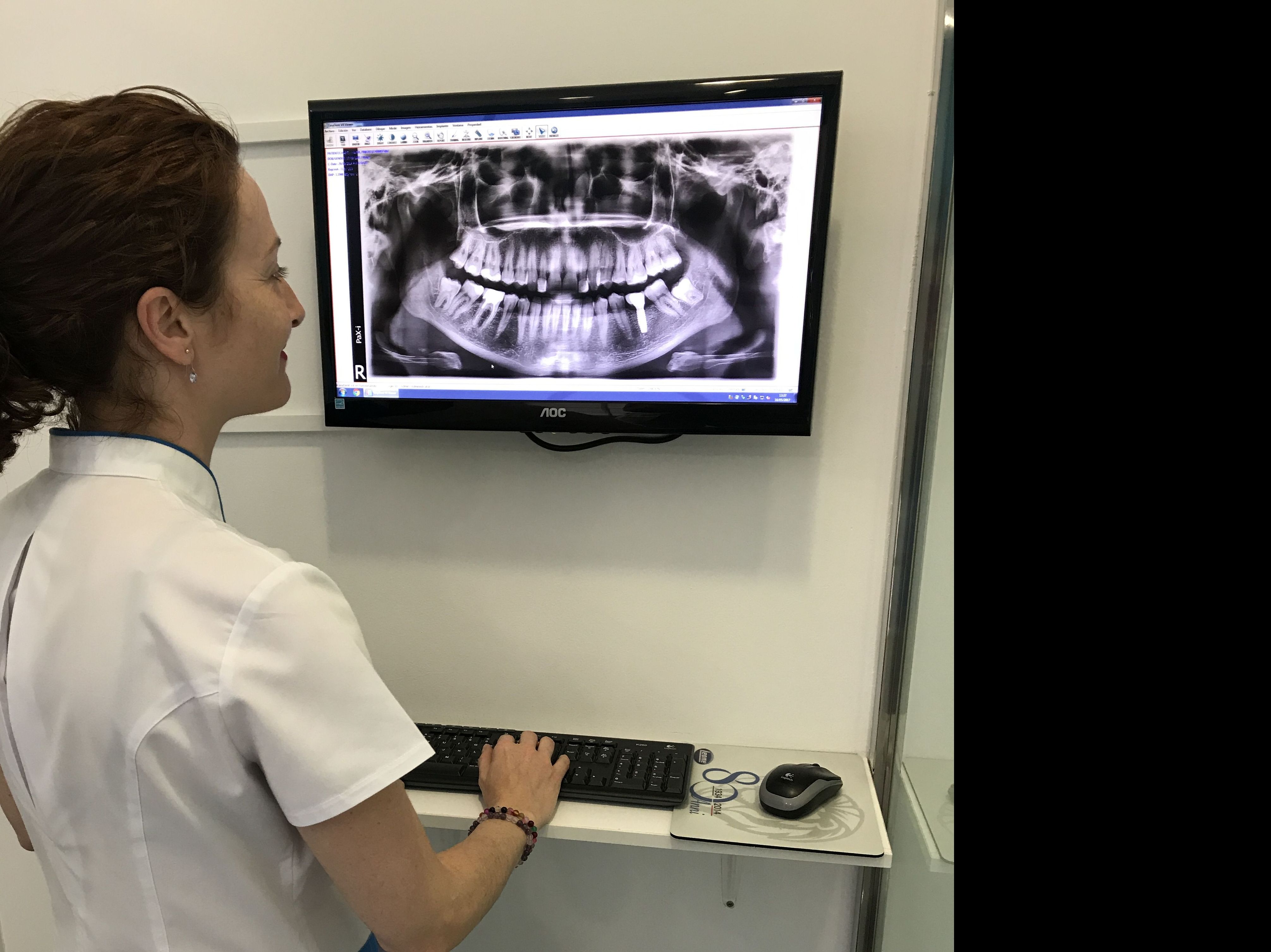 Radiografía Digital Clínica dental Fortaña-Giménez en Torrent, Valencia