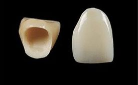 PORCELANA: ESPECIALIDADES de Clínica Dental Morey PORCELANA: ESPECIALIDADES de Clínica Dental Morey