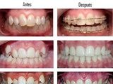 Ortodoncia: Especialidades de Centro Dental Unamuno Ortodoncia: Especialidades de Centro Dental Unamuno