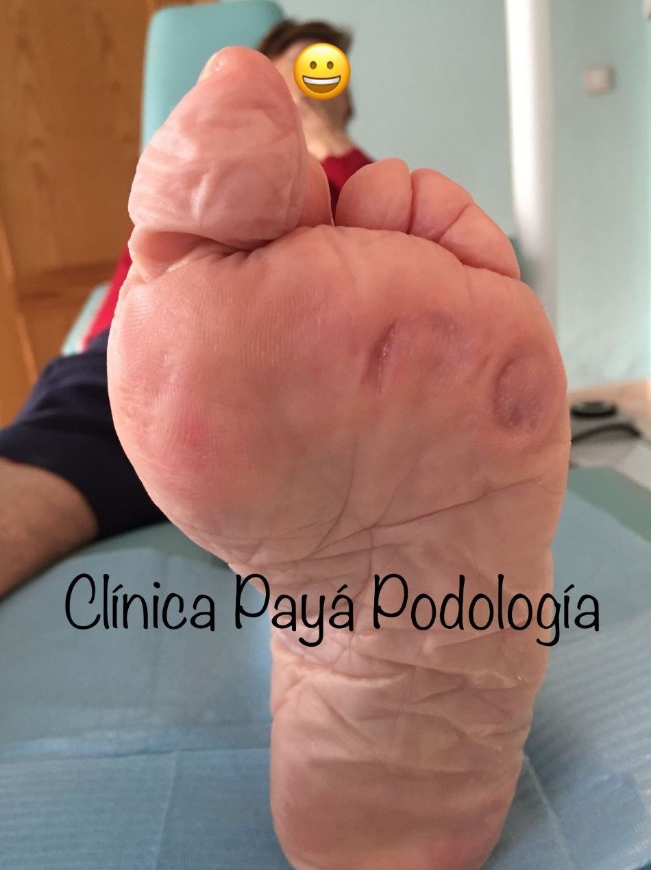 Podología Geriátrica: Tratamientos de Clínica Payá Podología Podología Geriátrica: Tratamientos de Clínica Payá Podología