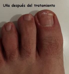Podología general: Tratamientos de Clínica Payá Podología Podología general: Tratamientos de Clínica Payá Podología