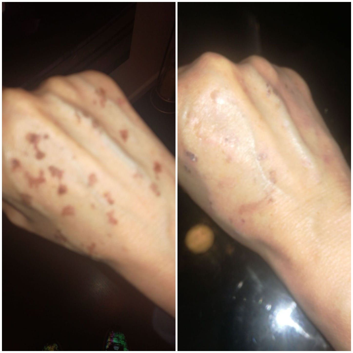 Eliminación de tatuajes: Servicios de Patri Calderón Estetic Eliminación de tatuajes: Servicios de Patri Calderón Estetic
