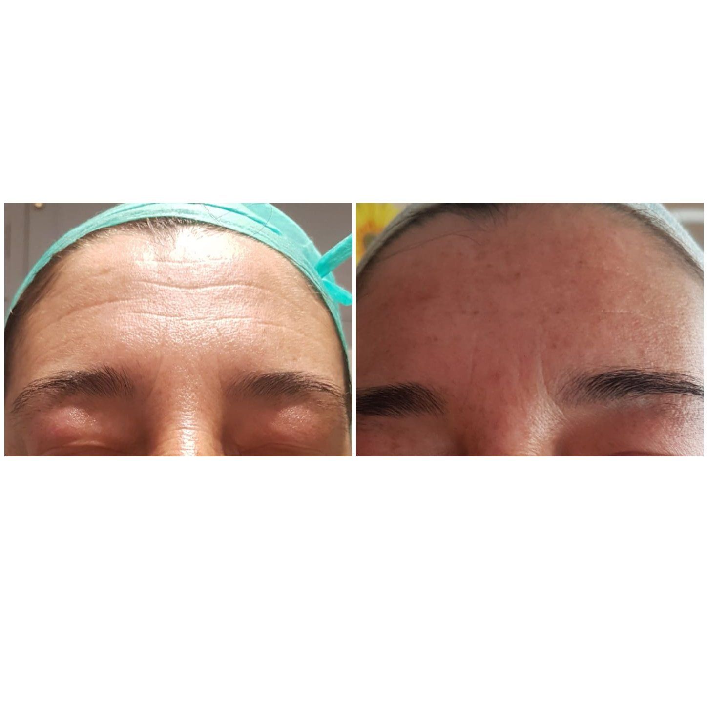 Tratamiento facial y corporal Hifu: Servicios de Patri Calderón Estetic Tratamiento facial y corporal Hifu: Servicios de Patri Calderón Estetic