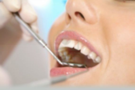 Periodoncia: Tratamientos de CLIESDENT - Clínica de Especialistas Dentales