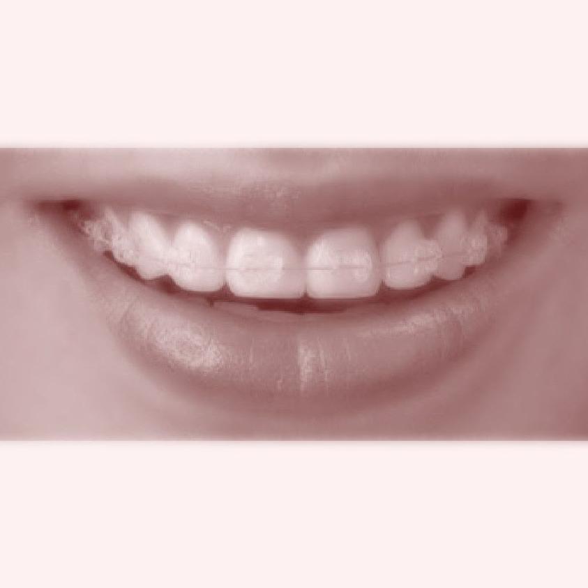 Ortodoncia: Tratamientos de Cliesdent Clínica de Especialistas Dentales - Nueva Dirección! Ortodoncia: Tratamientos de Cliesdent Clínica de Especialistas Dentales - Nueva Dirección!