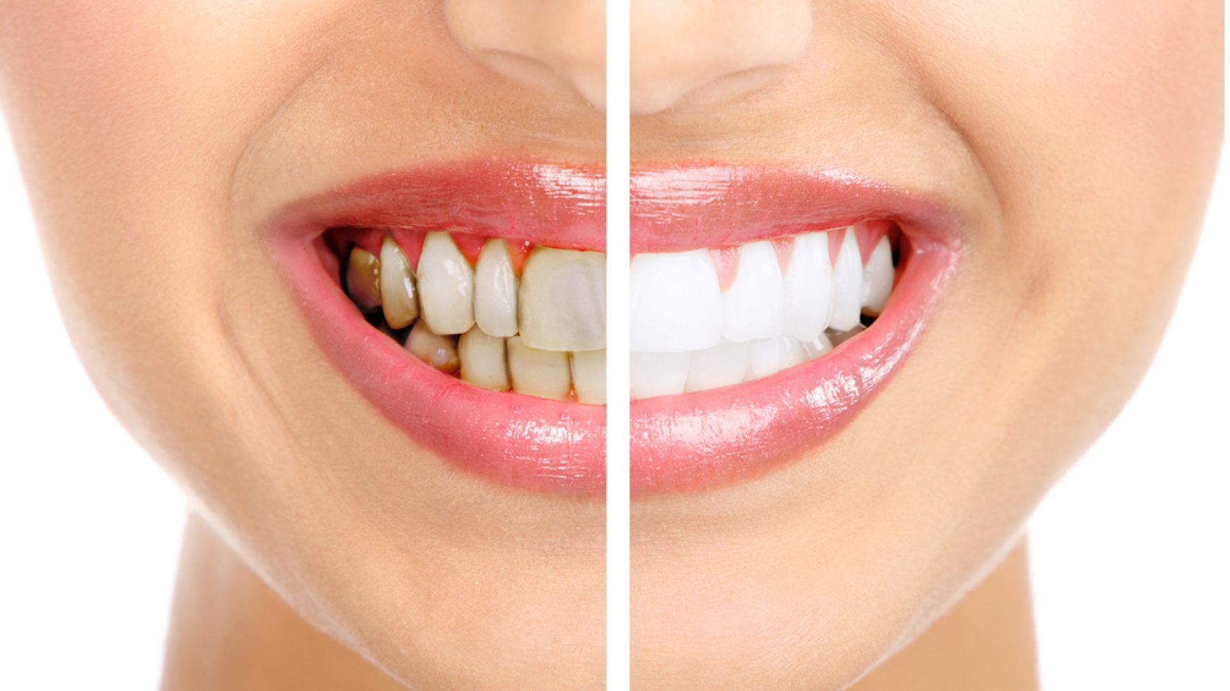 Rehabilitación oral estética: Tratamientos de Tuboca+ Clínica dental Goya Rehabilitación oral estética: Tratamientos de Tuboca+ Clínica dental Goya