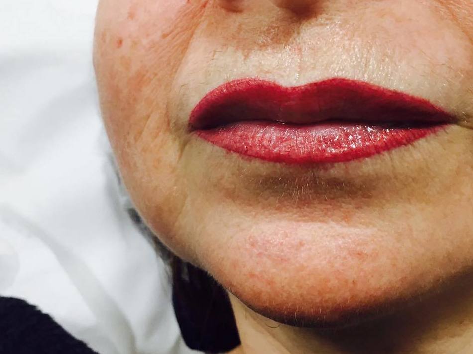 Después de una micropigmentación de labios Después de una micropigmentación de labios