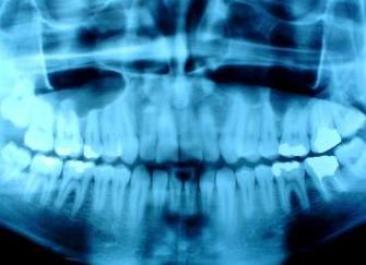 Rayos X digital: Servicios de Clínica Dental El Carmen