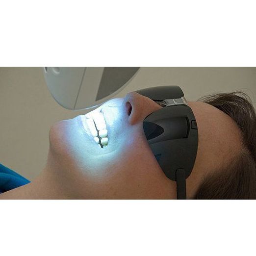 Blanqueamiento dental  : Servicios de Clínica Dental Dra. Belkys Hernández Cabrera