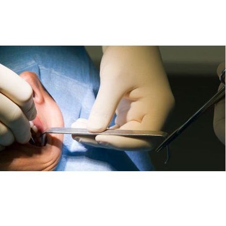 Extracciones dentales : Servicios de Clínica Dental Dra. Belkys Hernández Cabrera Extracciones dentales : Servicios de Clínica Dental Dra. Belkys Hernández Cabrera