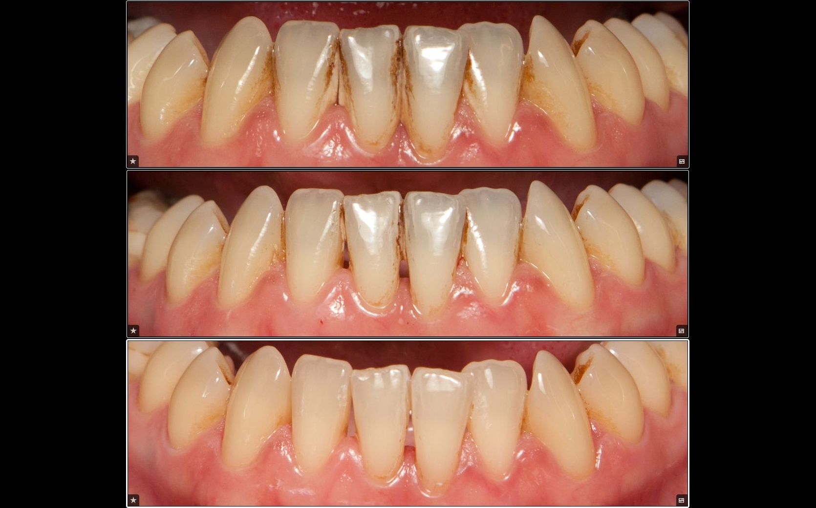 Limpieza dental : Servicios de Clínica Dental Dra. Belkys Hernández Cabrera Limpieza dental : Servicios de Clínica Dental Dra. Belkys Hernández Cabrera