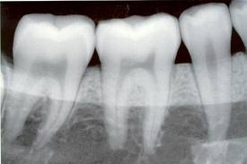 Radiografías: Servicios de Centro Dental Bizkai-Dent Radiografías: Servicios de Centro Dental Bizkai-Dent