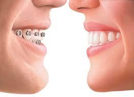 Ortodoncia: Servicios de Centro Dental Bizkai-Dent Ortodoncia: Servicios de Centro Dental Bizkai-Dent