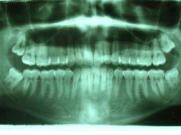 Ortopantomografia: Servicios de Centro Dental Bizkai-Dent Ortopantomografia: Servicios de Centro Dental Bizkai-Dent